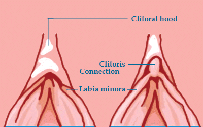 Clitorial Cuts