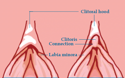 Clitoral Cuts