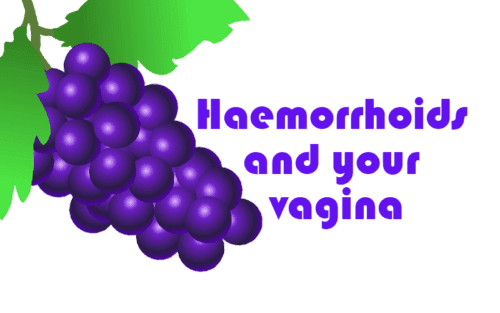 Haemorrhoids and your vagina My Vagina