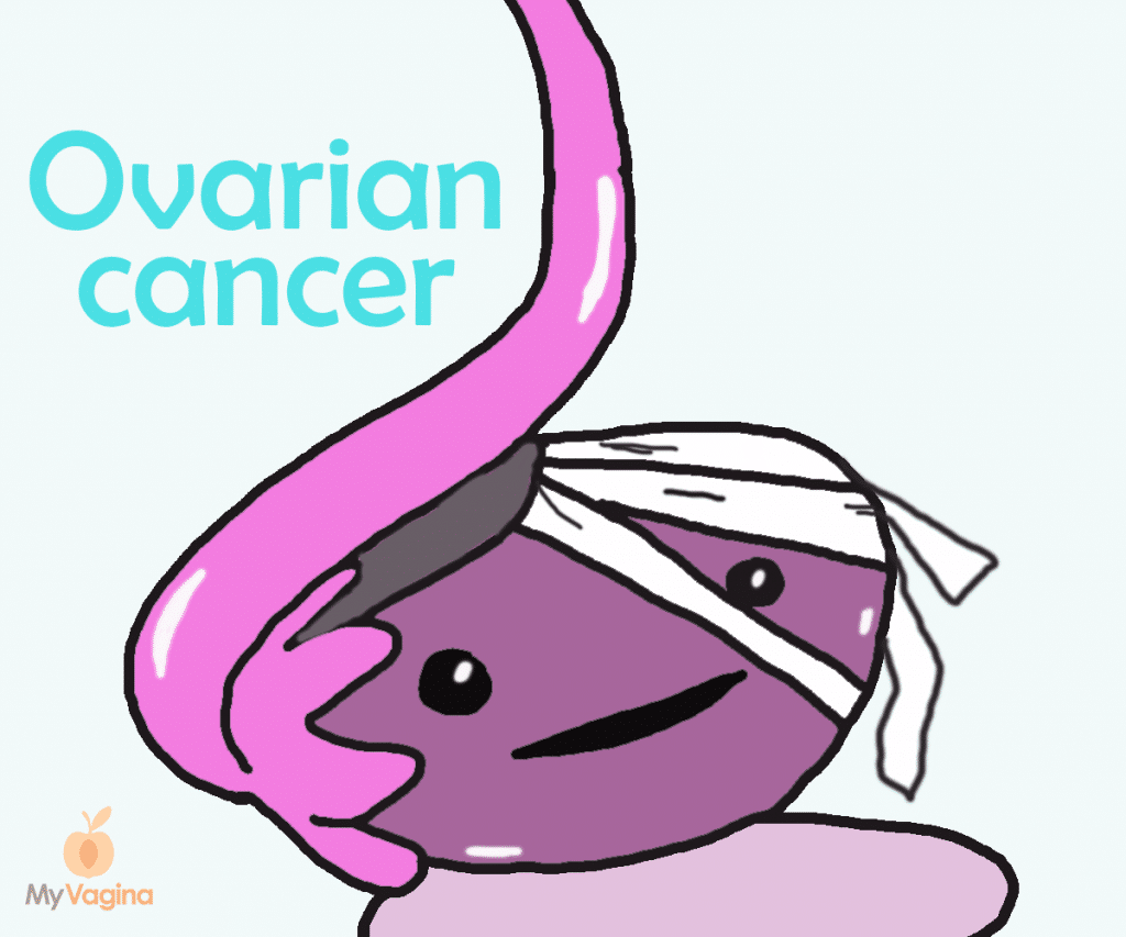 Ovarian Cancer - My Vagina