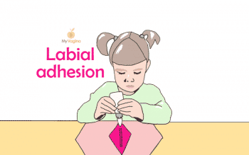 Labial adhesion labial agglutination My Vagina