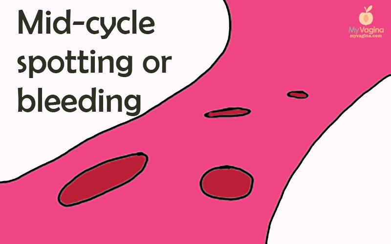 What is Spotting: Causes and Treatment of Spotting Before Period