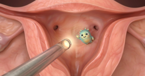 A torch shines into a pristine uterus, where a little friendly creature waves back